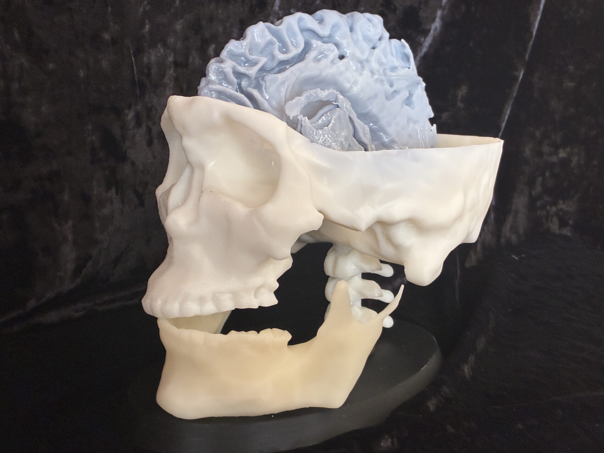 brain stem 3D printed